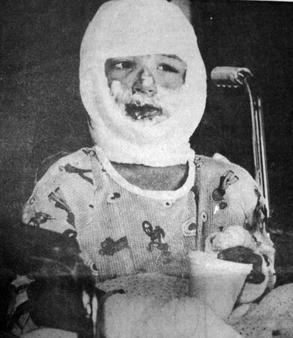 Ryan Taylor, 7, at the Montpelier, Idaho hospital after the Cokeville bombing. Casper Star-Tribune Collection, Casper College Western History Center.